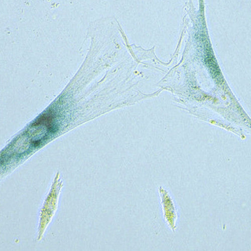 Are Zombies Hurting You?