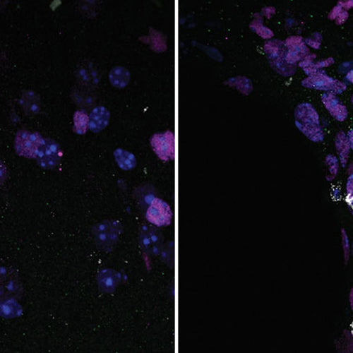 Invading Immune Cells May Damage Older Brains