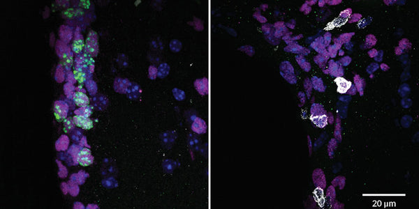 Invading Immune Cells May Damage Older Brains